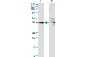 Western Blot analysis of RSAD2 expression in transfected 293T cell line by RSAD2 monoclonal antibody (M01), clone 4D10. (RSAD2 抗体  (AA 262-361))