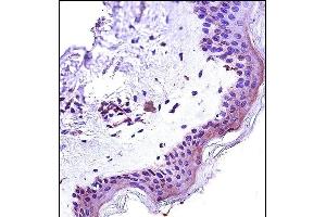 STAT2 Antibody (N-term) (ABIN657671 and ABIN2846664) immunohistochemistry analysis in formalin fixed and paraffin embedded human skin tissue followed by peroxidase conjugation of the secondary antibody and DAB staining.