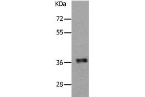 Western Blot analysis of Human fetal muscle tissue using PARD6A Polyclonal Antibody at dilution of 1:650 (PARD6A 抗体)