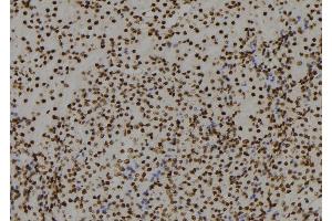 ABIN6279759 at 1/100 staining Mouse kidney tissue by IHC-P. (RGS22 抗体  (Internal Region))