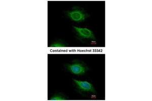 ICC/IF Image Immunofluorescence analysis of methanol-fixed HeLa, using ARF5, antibody at 1:500 dilution. (ARF5 抗体)