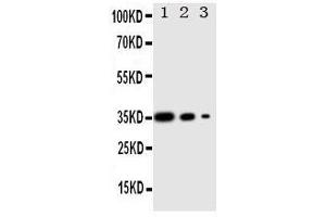 Western Blotting (WB) image for anti-Wingless-Type MMTV Integration Site Family, Member 2B (WNT2B) (AA 169-185), (Middle Region) antibody (ABIN3042967) (WNT2B 抗体  (Middle Region))