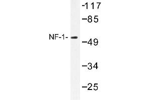 Image no. 1 for anti-Nuclear Factor I/A (NFIA) antibody (ABIN272219) (NFIA 抗体)