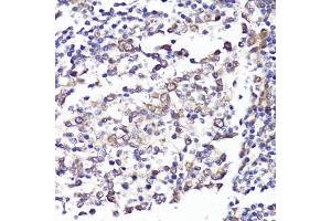 Immunohistochemistry of paraffin-embedded human tonsil using SELL antibody (ABIN3022263, ABIN3022264, ABIN3022265 and ABIN6218704) at dilution of 1:100 (40x lens). (L-Selectin 抗体  (AA 1-100))