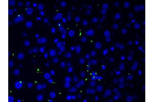 Immunofluorescence (fixed cells) (IF/ICC) image for anti-Collagen, Type II, alpha 1 (COL2A1) (N-Term) antibody (ABIN6260939)