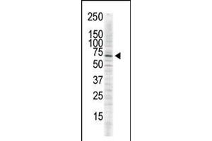 Antibody is used in Western blot to detect CAMK2 delta in serum-starved HeLa cell lysate. (CAMK2D 抗体  (C-Term))