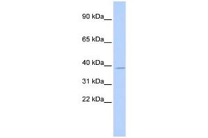 WB Suggested Anti-TSFM Antibody Titration: 0. (TSFM 抗体  (Middle Region))