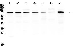 Western blot analysis of SAE2/UBA2 using anti-SAE2/UBA2 antibody . (UBA2 抗体  (AA 449-564))