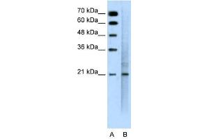 MUC1 antibody used at 0. (MUC1 抗体  (C-Term))