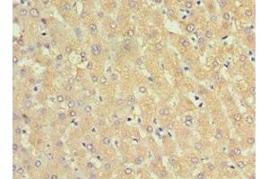 Immunohistochemistry (IHC) image for anti-serpin Peptidase Inhibitor, Clade A (Alpha-1 Antiproteinase, Antitrypsin), Member 3 (SERPINA3) (AA 24-423) antibody (ABIN7143754)