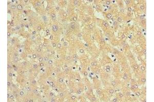 Immunohistochemistry of paraffin-embedded human liver tissue using ABIN7143754 at dilution of 1:100 (SERPINA3 抗体  (AA 24-423))