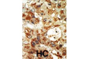 Immunohistochemistry (IHC) image for anti-Mitogen-Activated Protein Kinase 12 (MAPK12) antibody (ABIN5023083) (MAPK12 抗体)