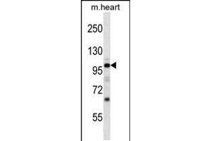 Western blot analysis in mouse heart tissue lysates (35ug/lane). (NPR1 抗体  (N-Term))