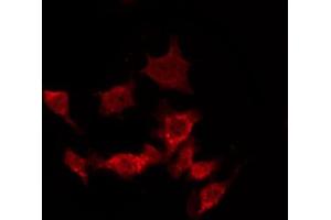 ABIN6269361 staining Hela by IF/ICC. (Caspase 8 抗体)