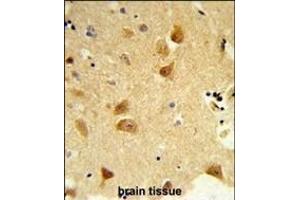 Immunohistochemistry (Paraffin-embedded Sections) (IHC (p)) image for anti-Der1-Like Domain Family, Member 1 (DERL1) (AA 224-251), (C-Term) antibody (ABIN652693)