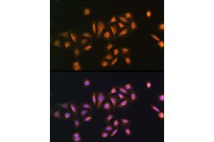 Immunofluorescence analysis of U2OS cells using STK38 antibody (ABIN6132692, ABIN6148616, ABIN6148617 and ABIN6224215) at dilution of 1:100. (STK38 抗体  (AA 1-200))