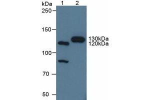 Western blot analysis of (1) Human HeLa cells and (2) Porcine Brain Tissue. (Contactin 4 抗体  (AA 731-980))