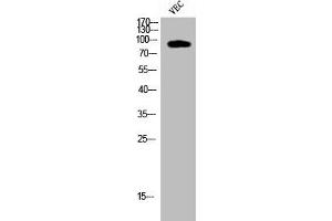 Western Blot analysis of VEC cells using Cleaved-COL1A2 (G1102) Polyclonal Antibody (COL1A2 抗体  (Cleaved-Gly1102))