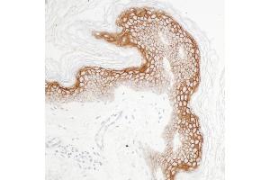 Immunohistochemistry (IHC) image for anti-Claudin 1 (CLDN1) (C-Term) antibody (ABIN7453966)