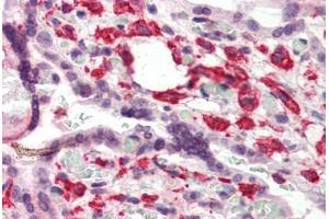 Human Placenta (formalin-fixed, paraffin-embedded) stained with DUSP1 antibody ABIN337195 at 5 ug/ml followed by biotinylated goat anti-rabbit IgG secondary antibody ABIN481713, alkaline phosphatase-streptavidin and chromogen. (DUSP1 抗体  (C-Term))