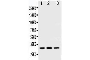 Anti-SDHB antibody, Western blotting All lanes: Anti SDHB  at 0. (SDHB 抗体  (N-Term))