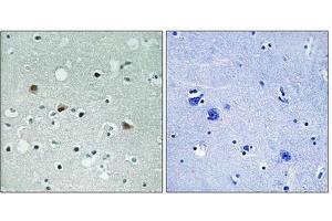 Immunohistochemical analysis of paraffin-embedded human brain tissue using LATS1/2 (Phospho-Thr1079/1041) antibody (left)or the same antibody preincubated with blocking peptide (right).
