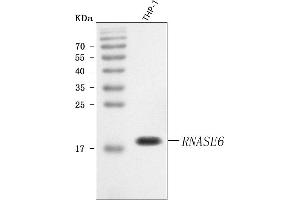 Western blot analysis of RNASE6 using anti-RNASE6 antibody (ABIN7600884).