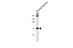 Western Blotting (WB) image for anti-Nudix (Nucleoside Diphosphate Linked Moiety X)-Type Motif 15 (NUDT15) (AA 89-118), (C-Term) antibody (ABIN654983)