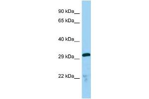 Host:  Rabbit  Target Name:  Tmx2  Sample Type:  Mouse Lung lysates  Antibody Dilution:  1. (TMX2 抗体  (C-Term))