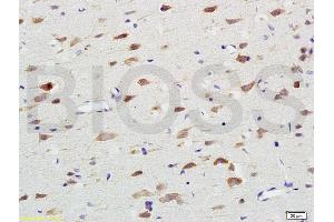 Formalin-fixed and paraffin embedded rat brain labeled with Anti-Nox4/NADH Polyclonal Antibody, Unconjugated (ABIN737526) at 1:200 followed by conjugation to the secondary antibody and DAB staining. (NADPH Oxidase 4 抗体  (AA 81-180))