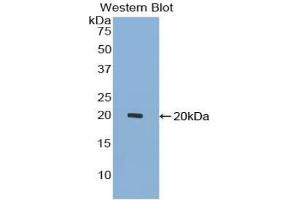 Western blot analysis of the recombinant protein. (GDF7 抗体  (AA 295-447))