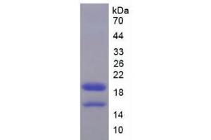 SDS-PAGE analysis of Mouse HMGA1 Protein. (HMGA1 蛋白)