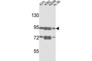 Western Blotting (WB) image for anti-ATP-Binding Cassette, Sub-Family B (MDR/TAP), Member 5 (ABCB5) antibody (ABIN3002513) (ABCB5 抗体)