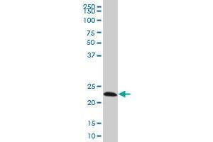 EFHD1 monoclonal antibody (M08A), clone 1F5 Western Blot analysis of EFHD1 expression in Hela S3 NE . (EFHD1 抗体  (AA 168-238))