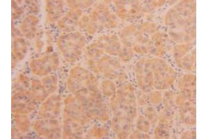 Figure. (TPSAB1 抗体  (AA 161-262))