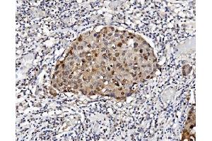 IHC analysis of PSMB5/MB1 using anti-PSMB5/MB1 antibody (ABIN7599183).