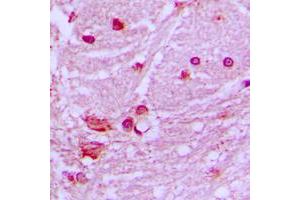 Immunohistochemical analysis of DNAL1 staining in human brain formalin fixed paraffin embedded tissue section. (DNAL1 抗体  (Center))