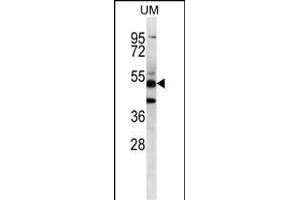 PNLIPRP3 Antibody (N-term) (ABIN656711 and ABIN2845941) western blot analysis in uterus tumor cell line lysates (35 μg/lane). (PNLIPRP3 抗体  (N-Term))