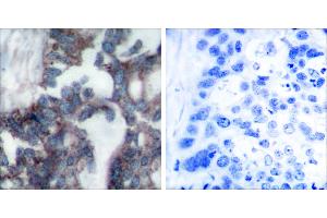 Peptide - +Immunohistochemical analysis of paraffin-embedded human breast carcinoma tissue using Claudin 1 antibody (#C0142). (Claudin 1 抗体)