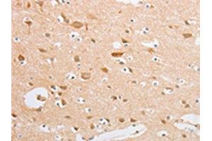 The image on the left is immunohistochemistry of paraffin-embedded Human brain tissue using ABIN7131039(SERPINE2 Antibody) at dilution 1/20, on the right is treated with fusion protein. (SERPINE2 抗体)
