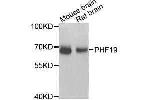 Western blot analysis of extracts of various cells, using PHF19 antibody. (PHF19 抗体)