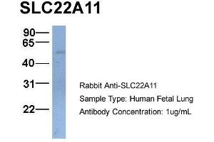 Host:  Rabbit  Target Name:  SLC22A11  Sample Type:  Human Fetal Lung  Antibody Dilution:  1. (SLC22A11 抗体  (C-Term))