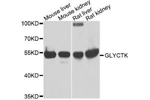 Western blot analysis of extracts of various cells, using GLYCTK antibody. (GLYCTK 抗体)