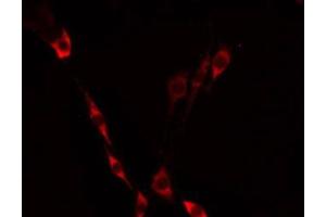 ABIN6275233 staining Hela by IF/ICC. (MRPS21 抗体  (C-Term))