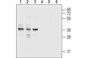 Western blot analysis of acute monocytic leukemia THP-1 (lanes 1 and 4), promyelocytic leukemia HL-60 (lanes 2 and 5) and acute T-cell leukemia Jurkat (lanes 3 and 6) human cell lysates: - 1,2,3. (CysLTR1 抗体  (3rd Extracellular Loop))