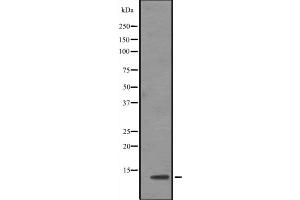 Western blot analysis of TCEB1 expression in Jurkat cell line lysates ,The lane on the left is treated with the antigen-specific peptide.