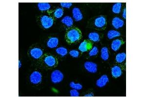 IF analysis of PICALM using anti-PICALM antibody (ABIN7599516).
