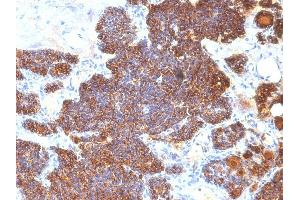 Formalin-fixed, paraffin-embedded human Parathyroid stained with PTH Monoclonal Antibody (PTH/1174). (PTH 抗体  (AA 32-115))