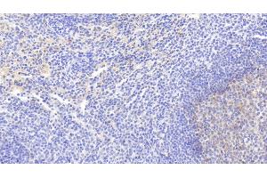 Detection of VCAM1 in Rabbit Spleen Tissue using Monoclonal Antibody to Vascular Cell Adhesion Molecule 1 (VCAM1)