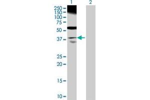 Western Blot analysis of RP2 expression in transfected 293T cell line by RP2 MaxPab polyclonal antibody. (RP2 抗体  (AA 1-350))